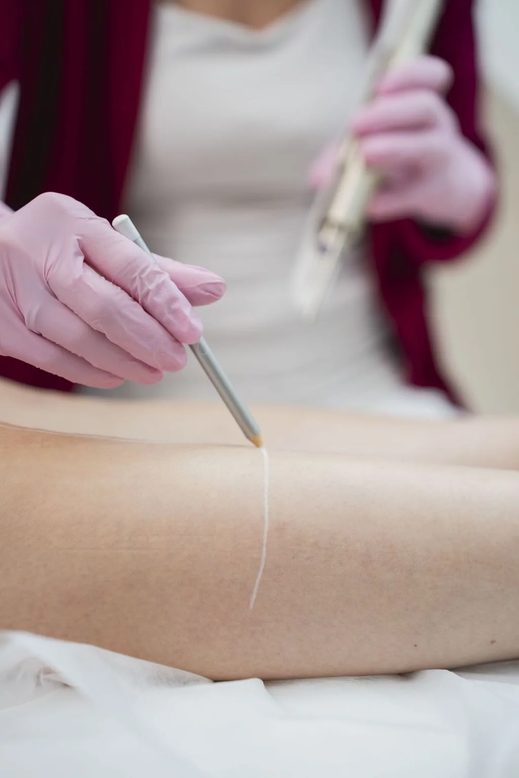 Haarentfernung in Wien – Dr. Nicole Egger