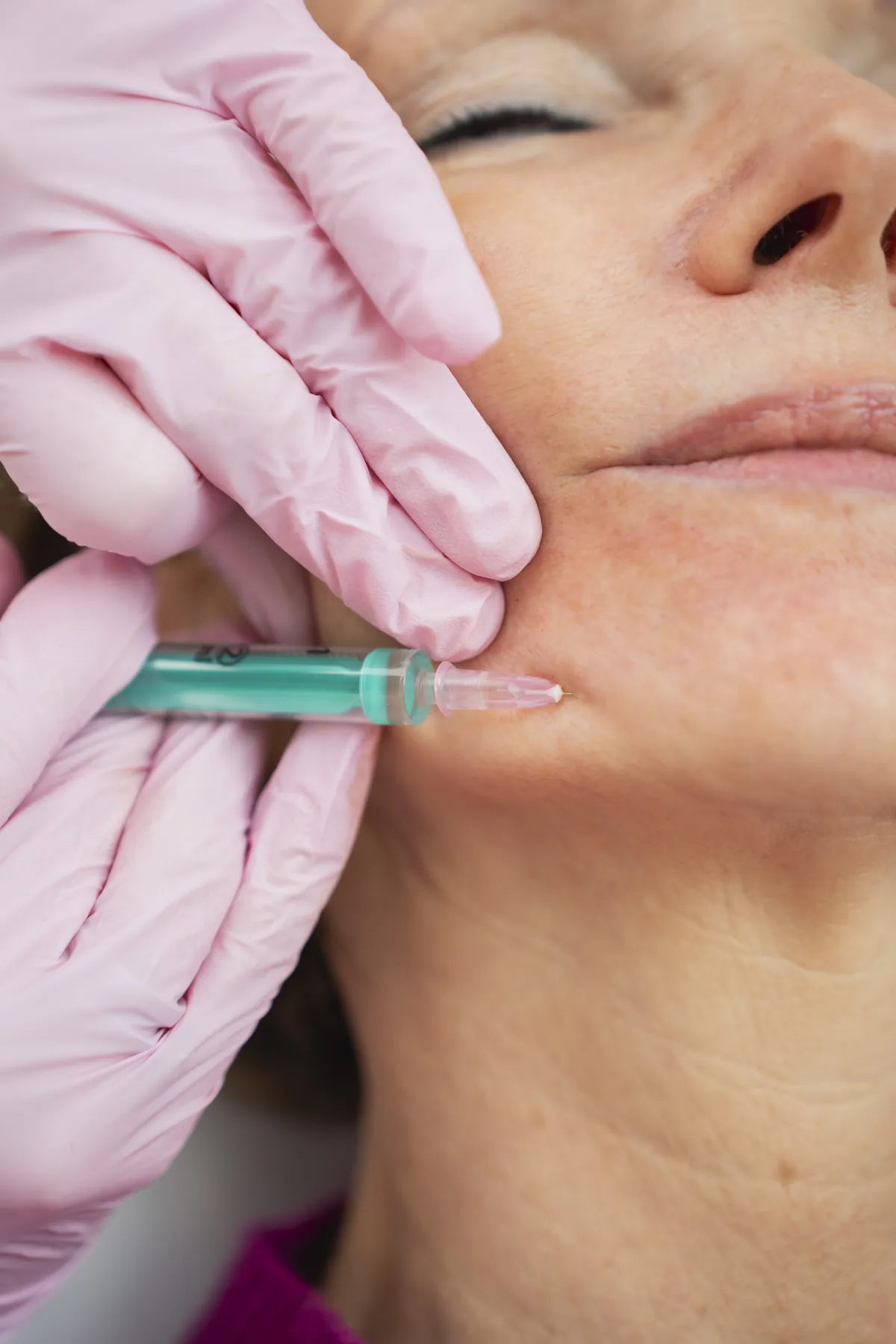 Skinbooster in Wien – Dr. Nicole Egger